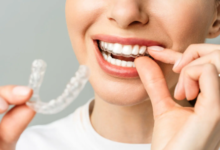 Smile Comeback: Restoring Teeth After Sports Injuries