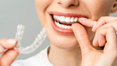 Smile Comeback: Restoring Teeth After Sports Injuries