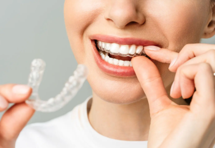 Smile Comeback: Restoring Teeth After Sports Injuries
